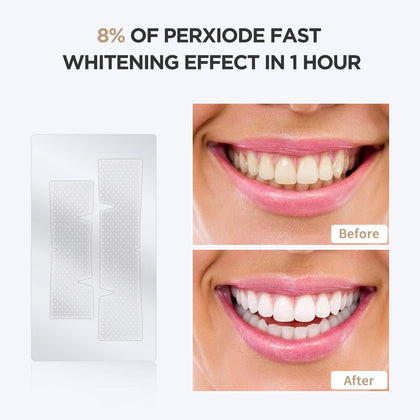 Fairywill Express Teeth Whitening Strips 20 Pcs - شرائط تبييض الأسنان